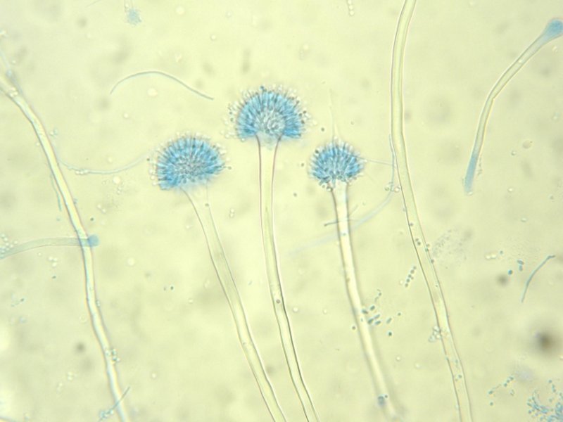 Microscopic view of koji mold showing spores and hyphae